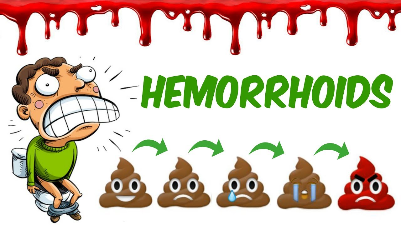 haemorrhois