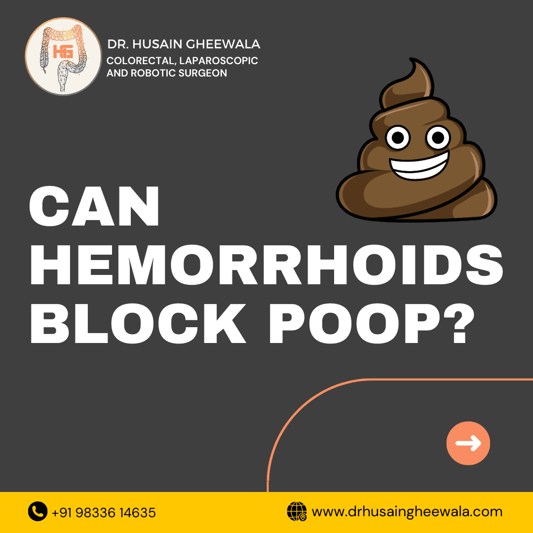 Graphic with text Can Hemorrhoids Block Poop? featuring a smiling poop emoji and doctor's contact info.