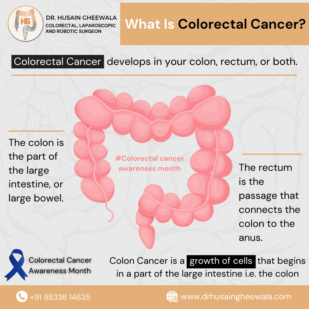 Colorectal cancer diagram explaining development in colon and rectum, with awareness month information from Dr. Husain Gheewala.