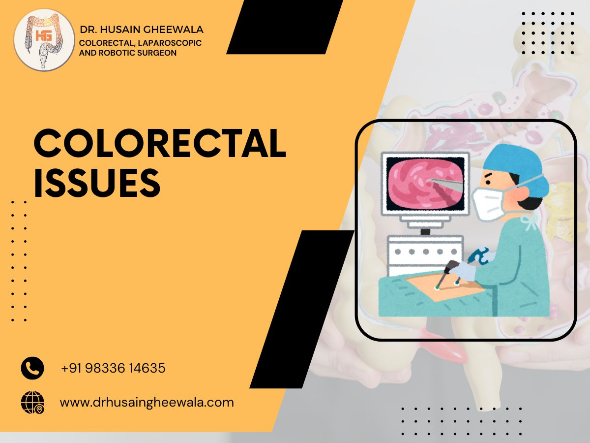 Colorectal issues and surgery illustration by Dr. Husain Gheewala, specialist in laparoscopic and robotic procedures.