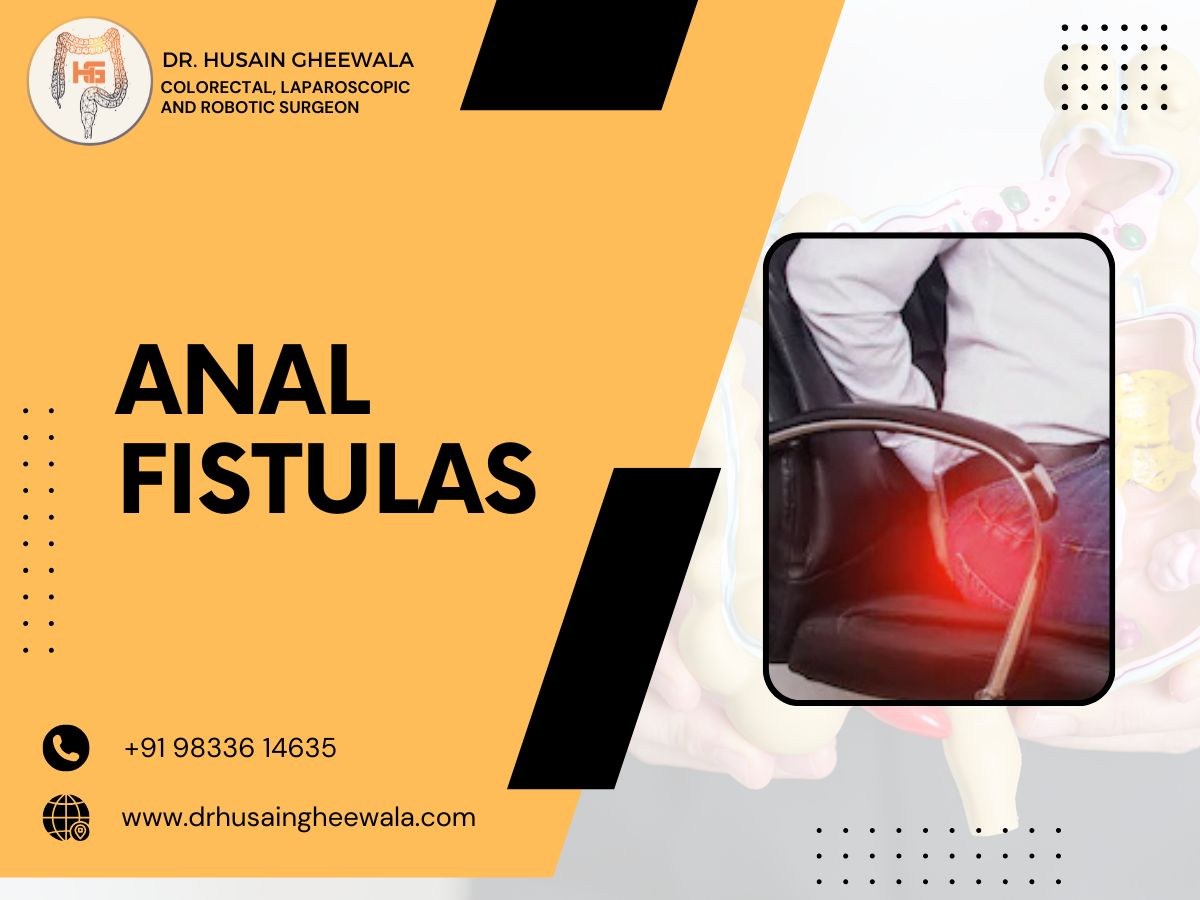 Fistula vs. Hemorrhoids vs. Fissures: How to Tell the Difference 1 image 3